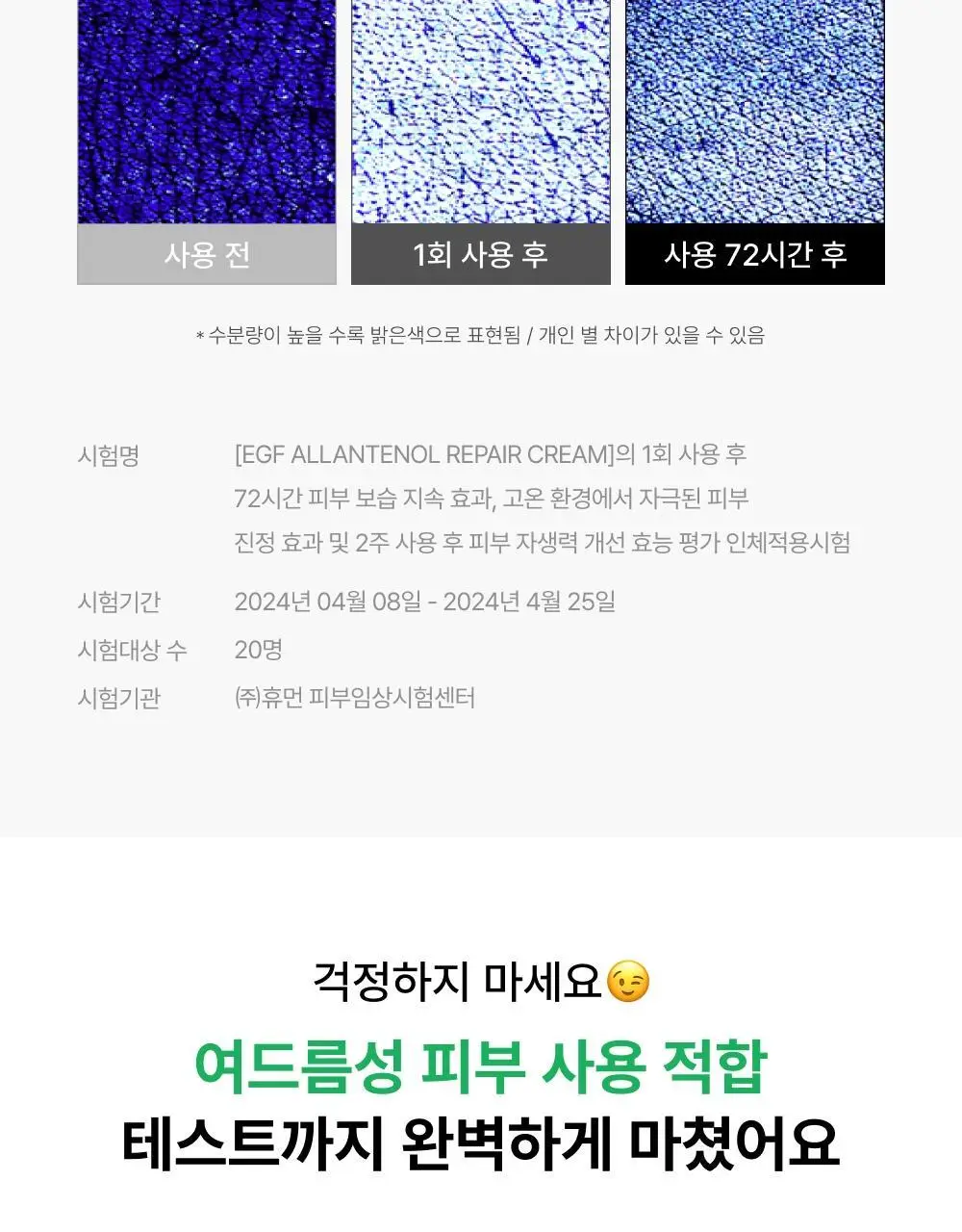[수분/진정] 셀인샷 EGF 알란테놀 트러블 크림 70ml 상세페이지 16